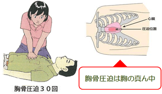 イラスト：胸骨圧迫を行う女性