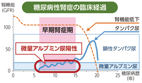 マイナス 尿 蛋白 プラス 腎機能の尿たんぱく検査で（±）プラスマイナスがでたけど大丈夫？