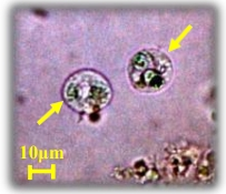 Microcystisを捕食するMonas sp.の写真
